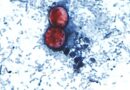Microscópio mostra oócitos de Cyclospora cayetanensis, parasita causador da cyclosporíase