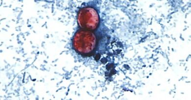 Microscópio mostra oócitos de Cyclospora cayetanensis, parasita causador da cyclosporíase