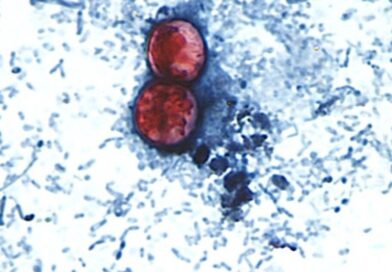 Microscópio mostra oócitos de Cyclospora cayetanensis, parasita causador da cyclosporíase